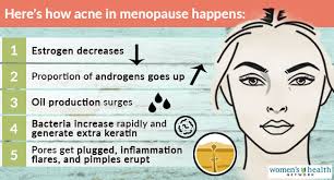 acne in menopause